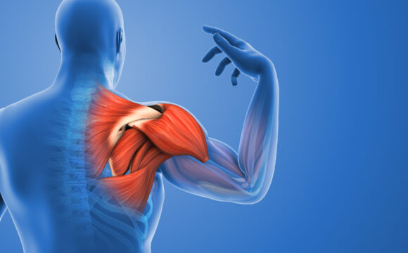 Ruptura coafei rotatorilor