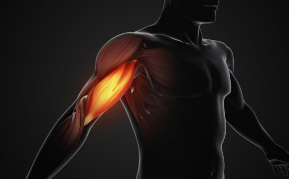 Tendinita bicipitala , leziune SLAP