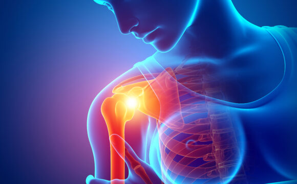 Entorsa și disjuncția acromioclaviculară