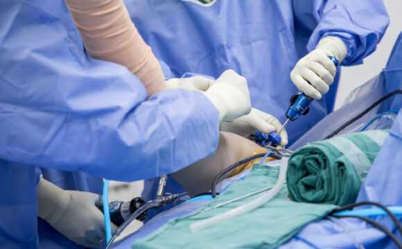 Artroscopia de umăr