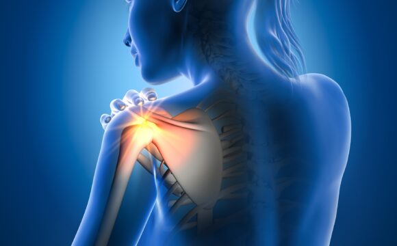 Tendinopatiile cronice ale coafei rotatorilor