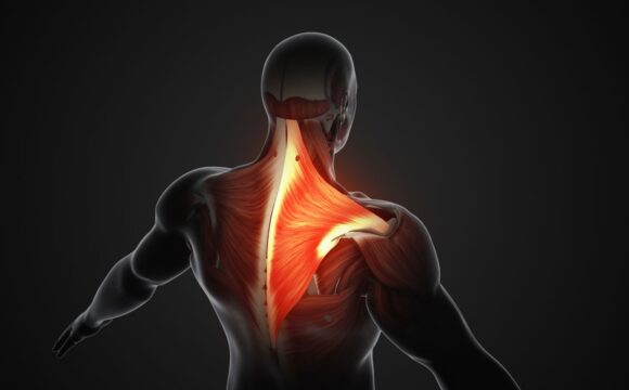 Transferurile tendinoase în chirurgia umărului – trapez inferior și latissimus dorsi