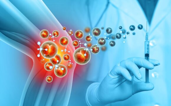 Infiltrații periarticulare și intraarticulare