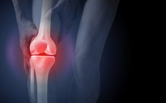 Leziunile de cartilaj condropatia