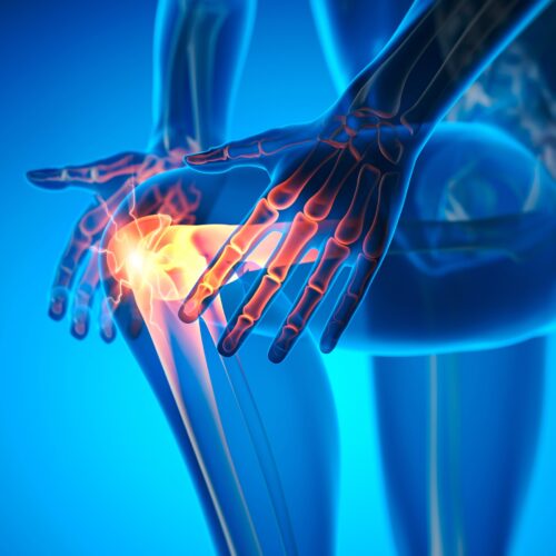 Leziunile pluriligamentare