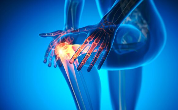 Leziunile pluriligamentare